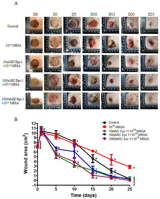 Epi-1 cures MRSA infection in heat burn wounds