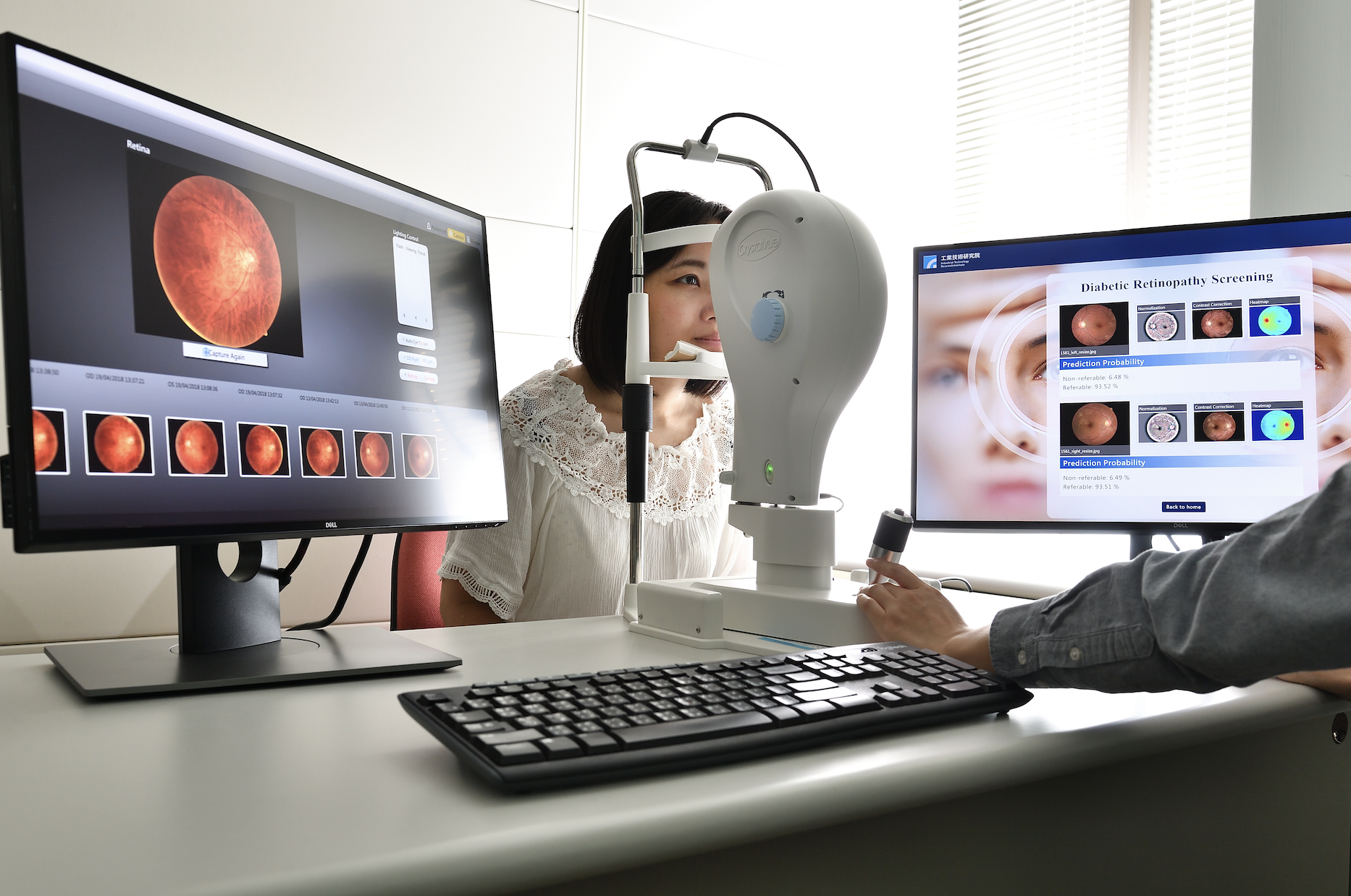 AI Decision Support Technology of Fundus Image in Diabetes Mellitus