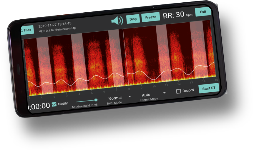 Mobile Respiratory Monitor: supports continuous respiratory monitoring using AI. 