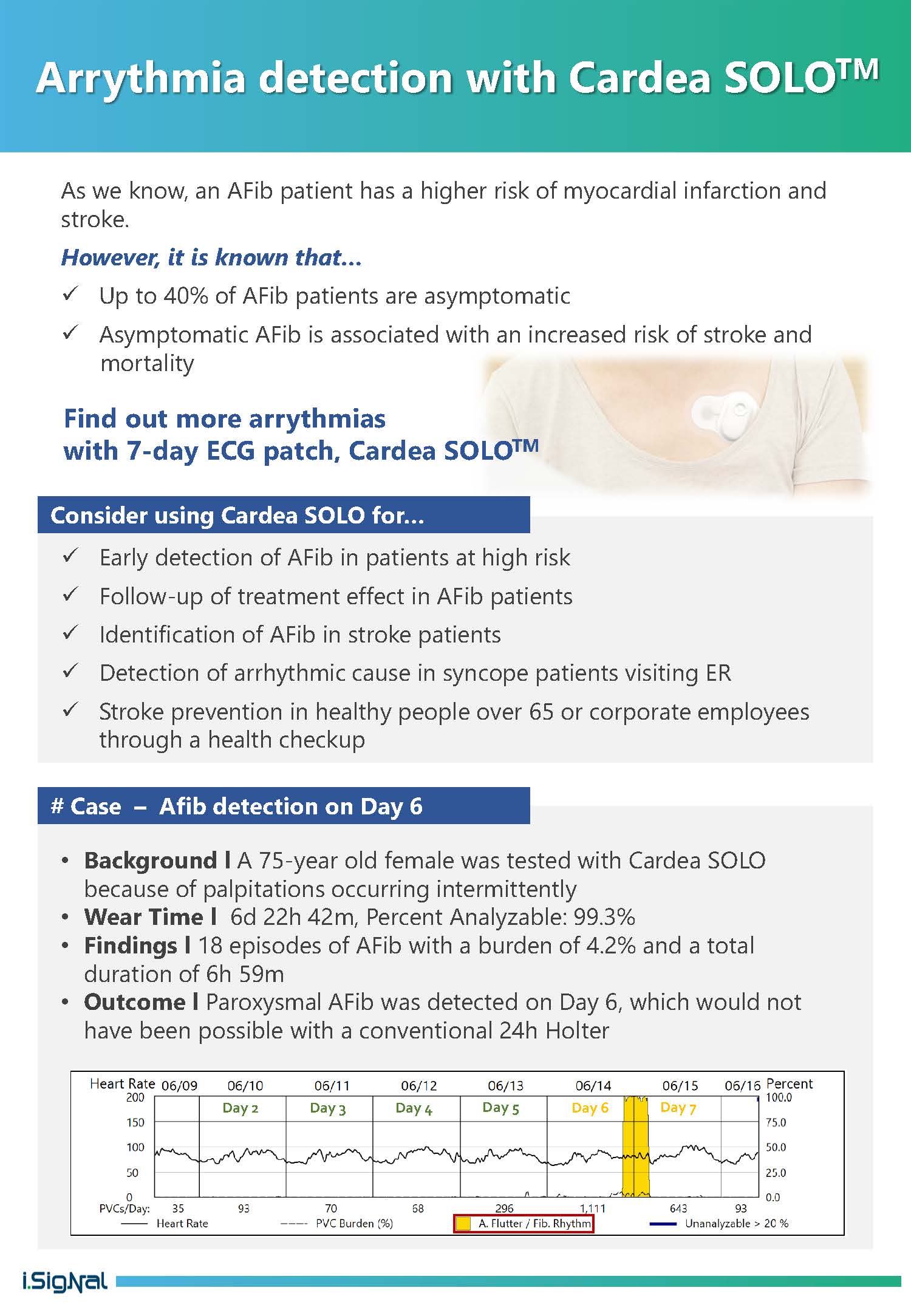 Why CARDEA SOLO™ (3)